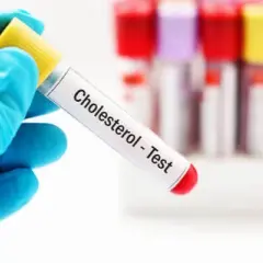 Czy stres podnosi cholesterol? Odkryj niebezpieczne skutki dla zdrowia