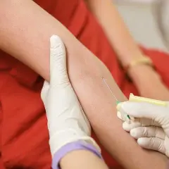 Czy wysoki cholesterol powoduje tycie? Odkryj prawdę o zdrowiu