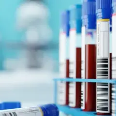Jaki cholesterol jest niebezpieczny i jak uniknąć zagrożeń zdrowotnych