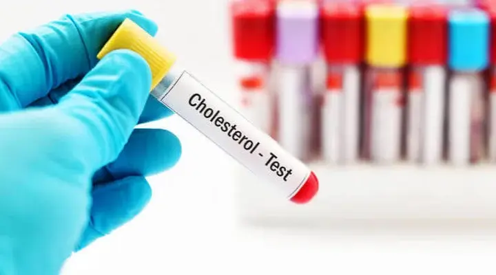 Czy stres podnosi cholesterol? Odkryj niebezpieczne skutki dla zdrowia