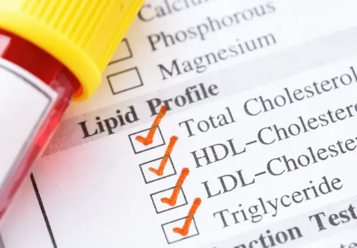 Jak się przygotować do badania cholesterolu, by uniknąć błędów?