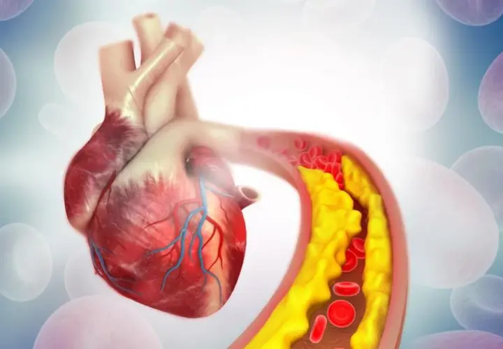 Jak sprawdzić cholesterol: kluczowe metody i ważne przygotowania