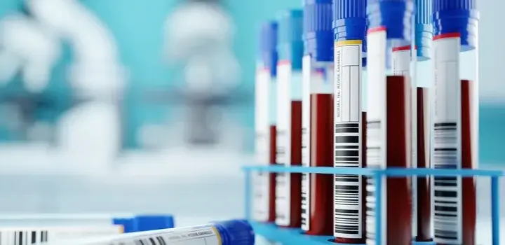 Jaki cholesterol jest niebezpieczny i jak uniknąć zagrożeń zdrowotnych