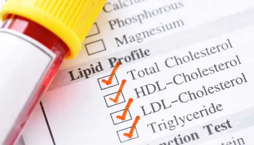 Jak się przygotować do badania cholesterolu, by uniknąć błędów?