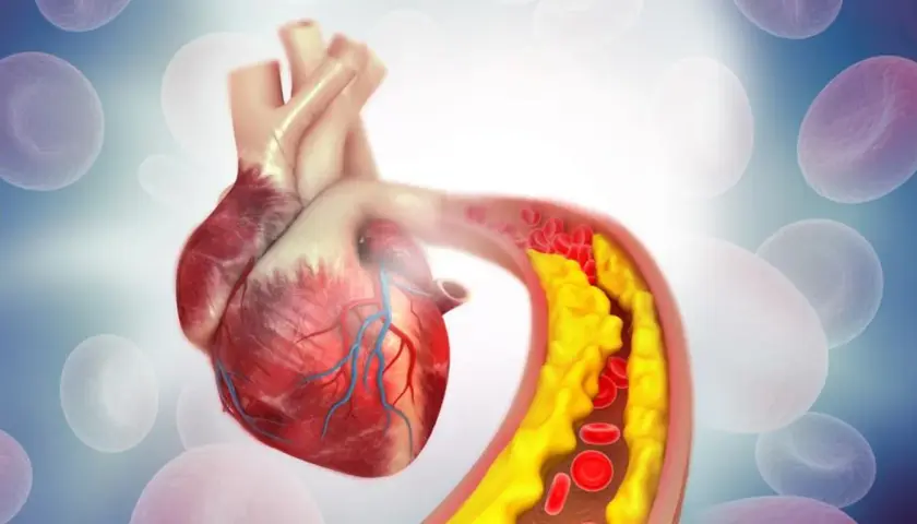 Jak sprawdzić cholesterol: kluczowe metody i ważne przygotowania