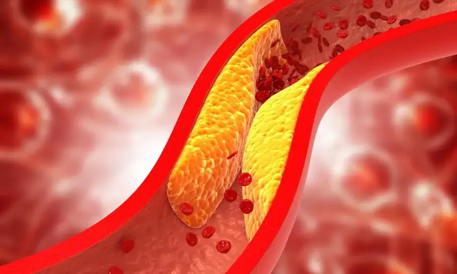 Zdjęcie Czy słodycze podnoszą cholesterol? Fakty, które musisz znać